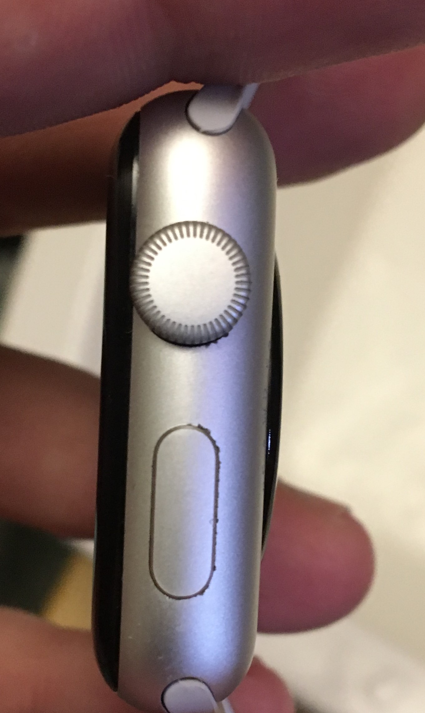 Apple Watch S3 problem Corrosion around… Apple Community