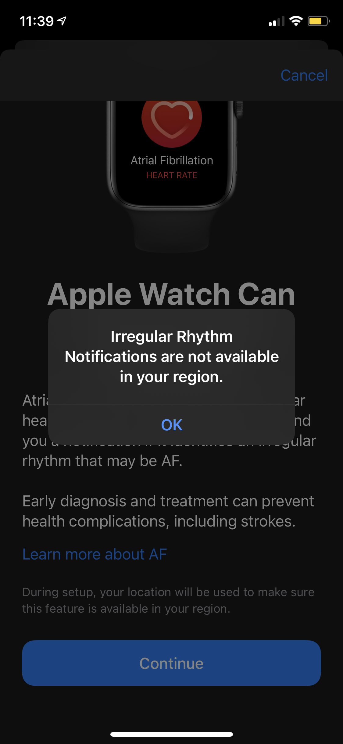 Apple watch ecg not 2024 available in your region