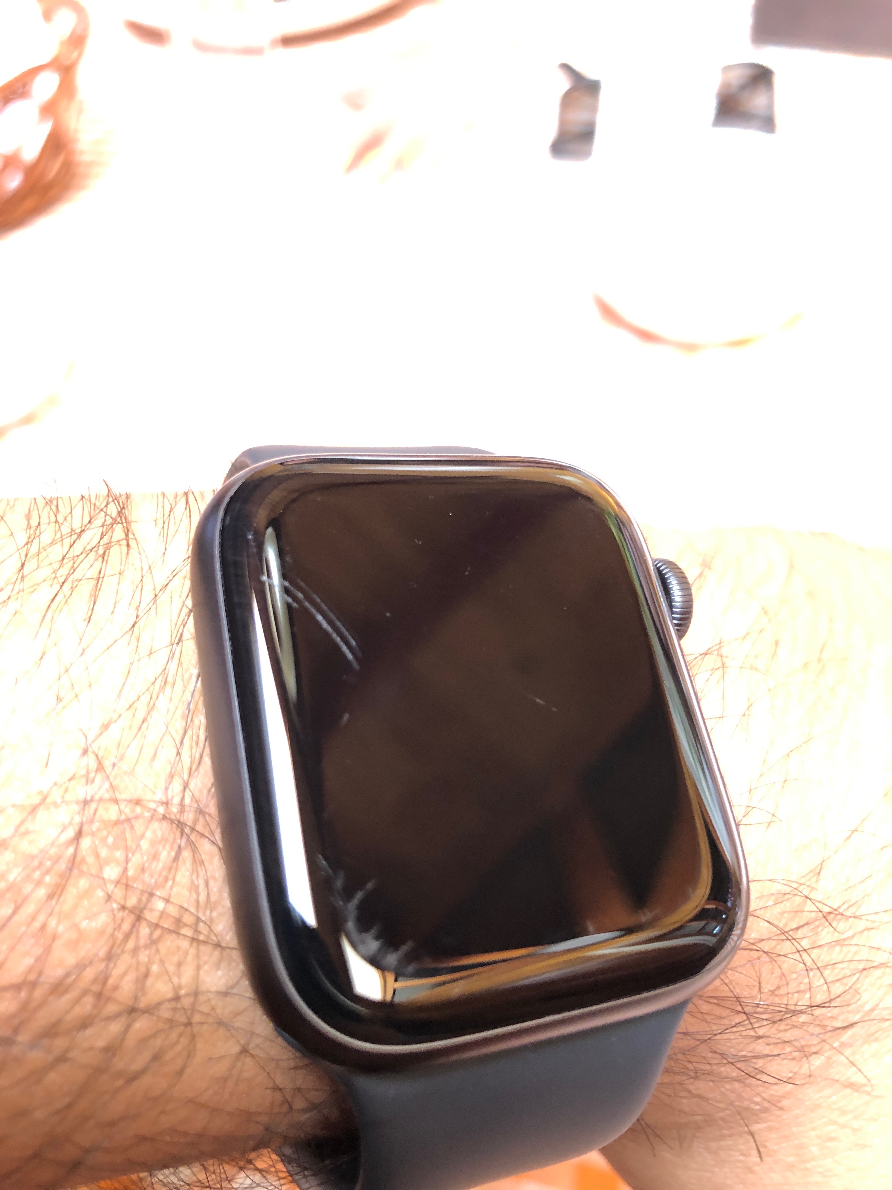 Remove Apple Watch Scratches Yourself - No Screen Replacement - Latest  Application - Zcratch UV 