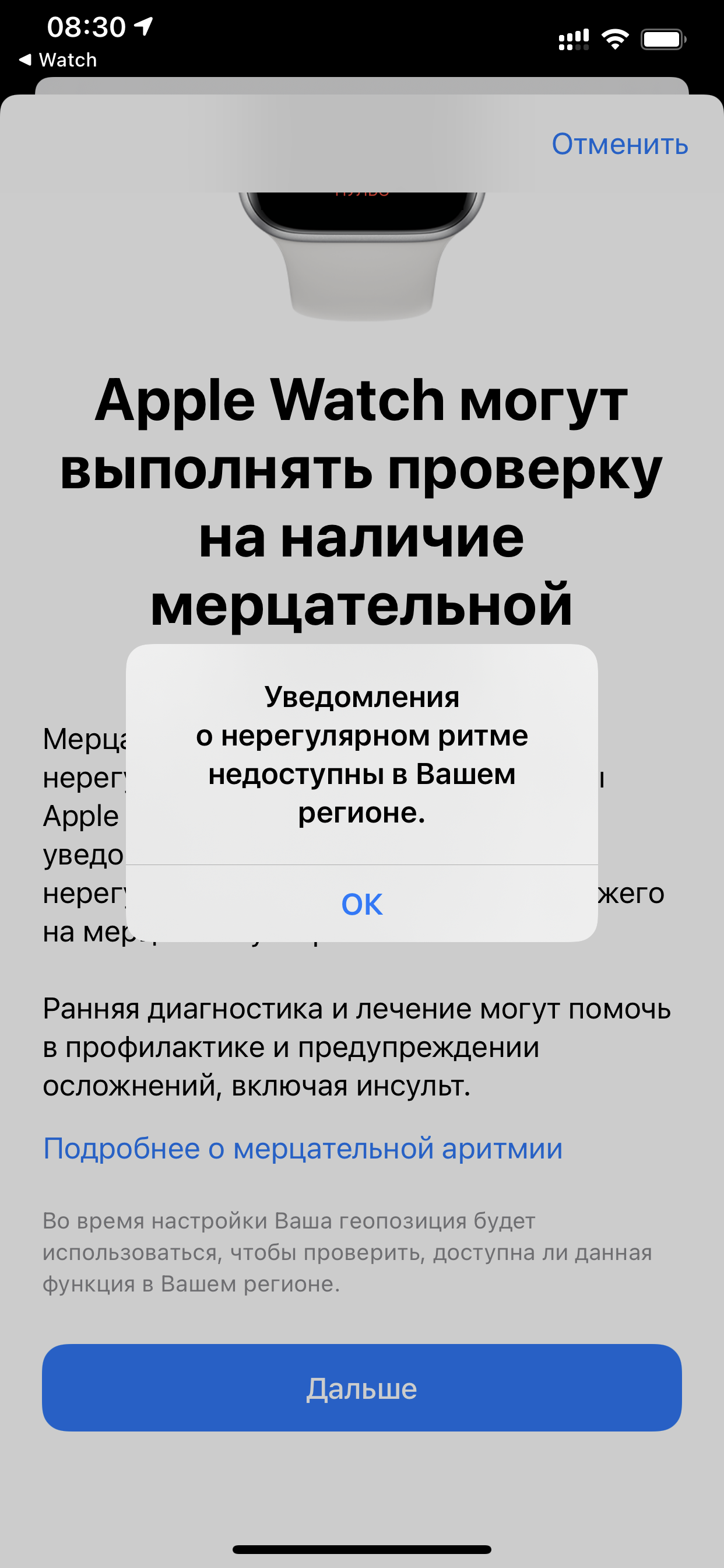 Функция ЭКГ в моем регионе не доступна - Apple Community