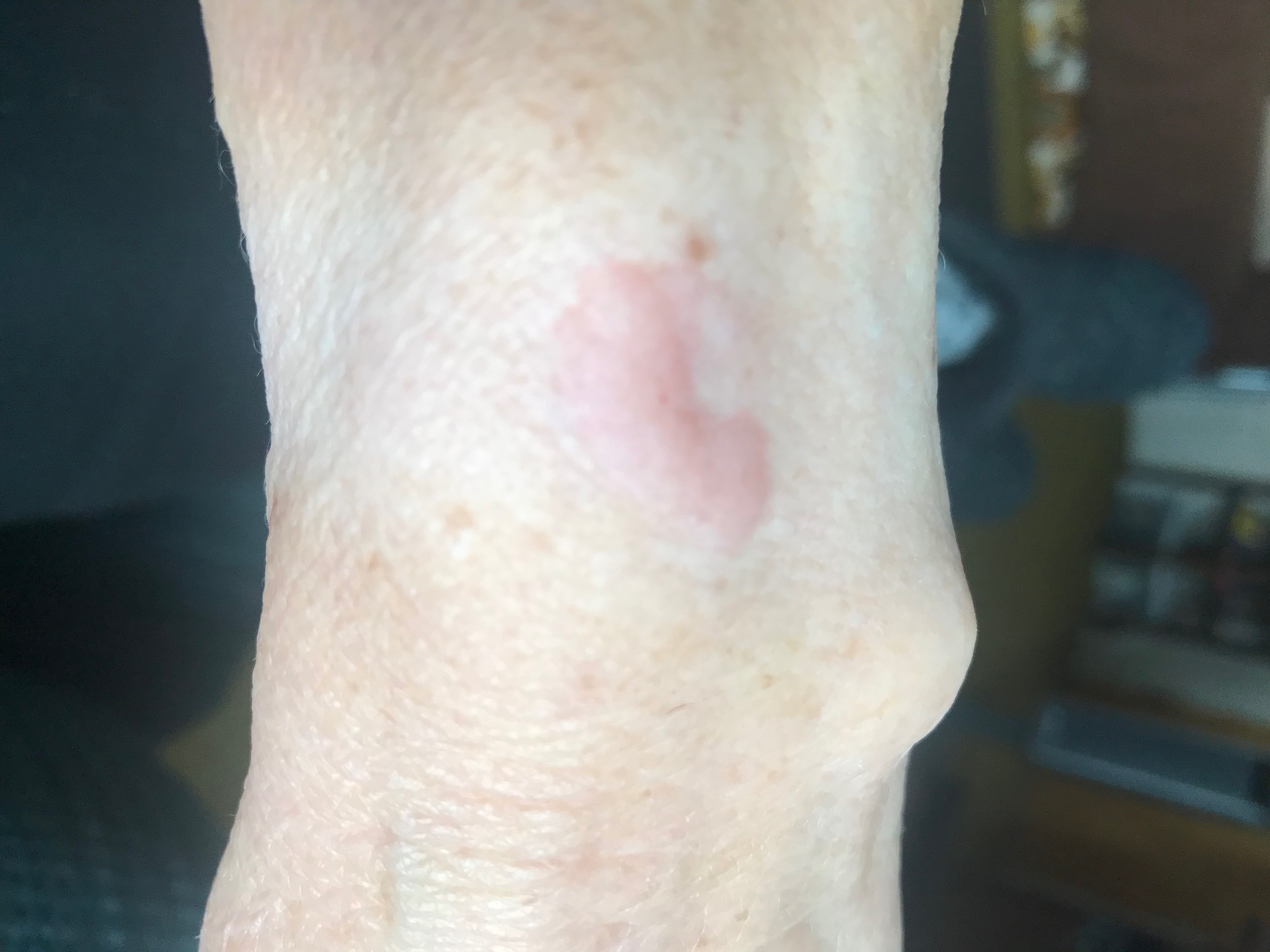 Apple Watch Apple Community