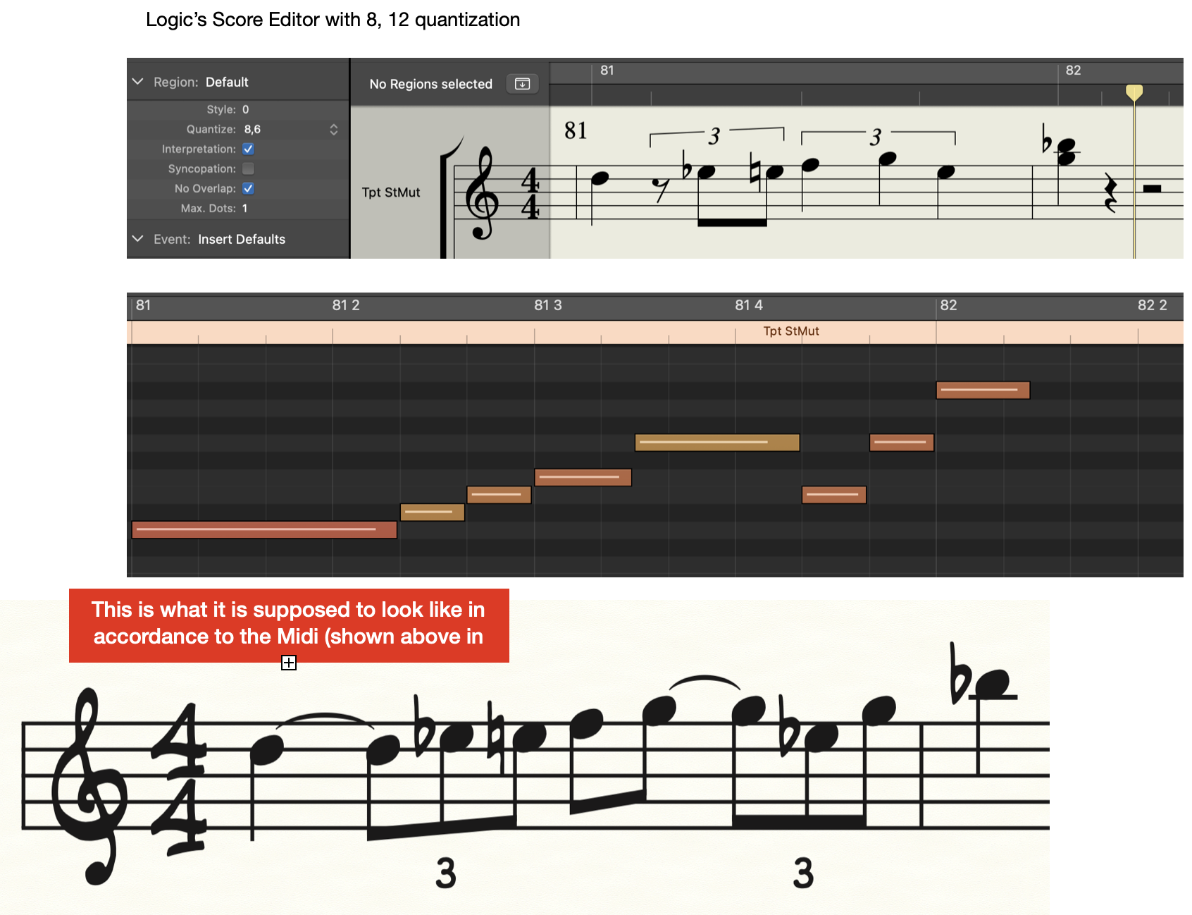 score-editor-quantization-8-12-not-worki-apple-community