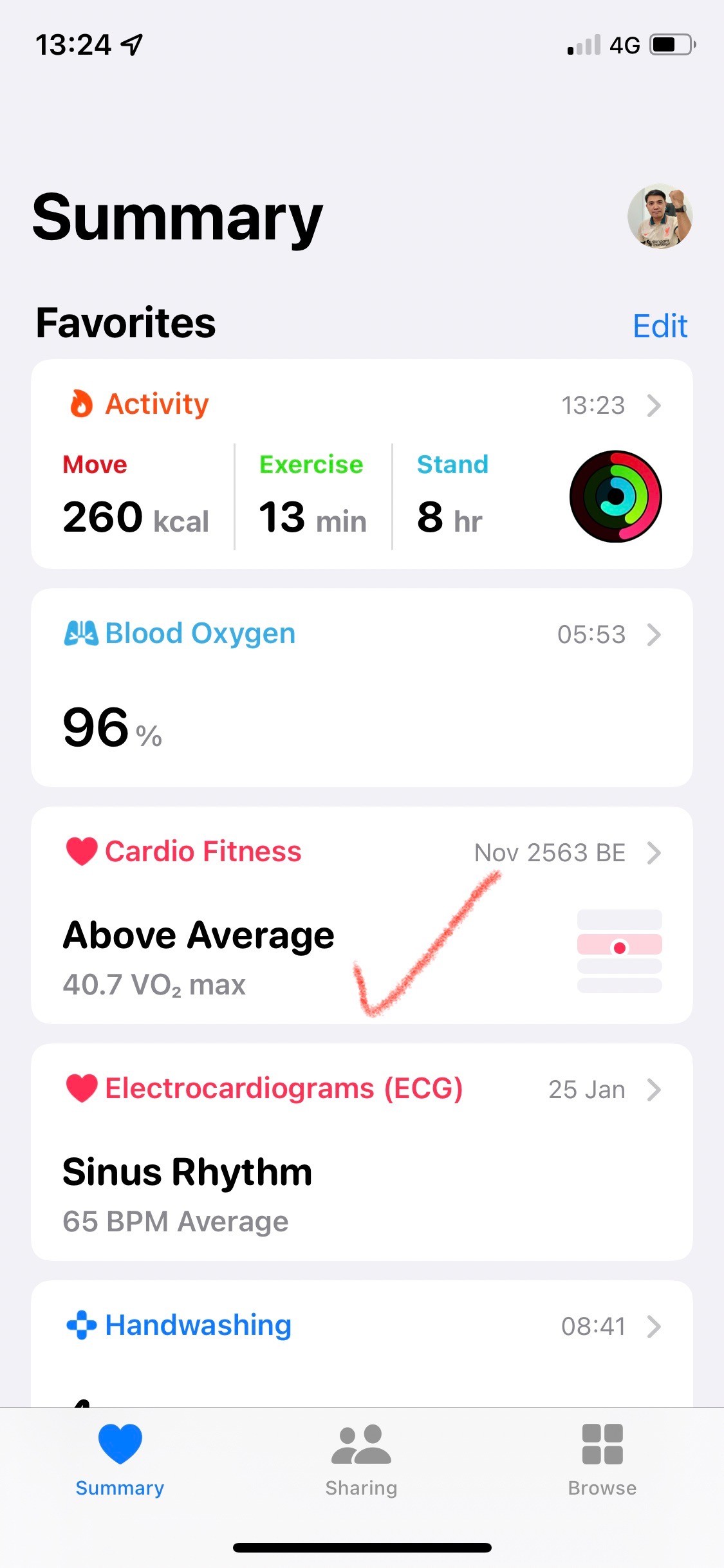 Apple Watch Apple Community