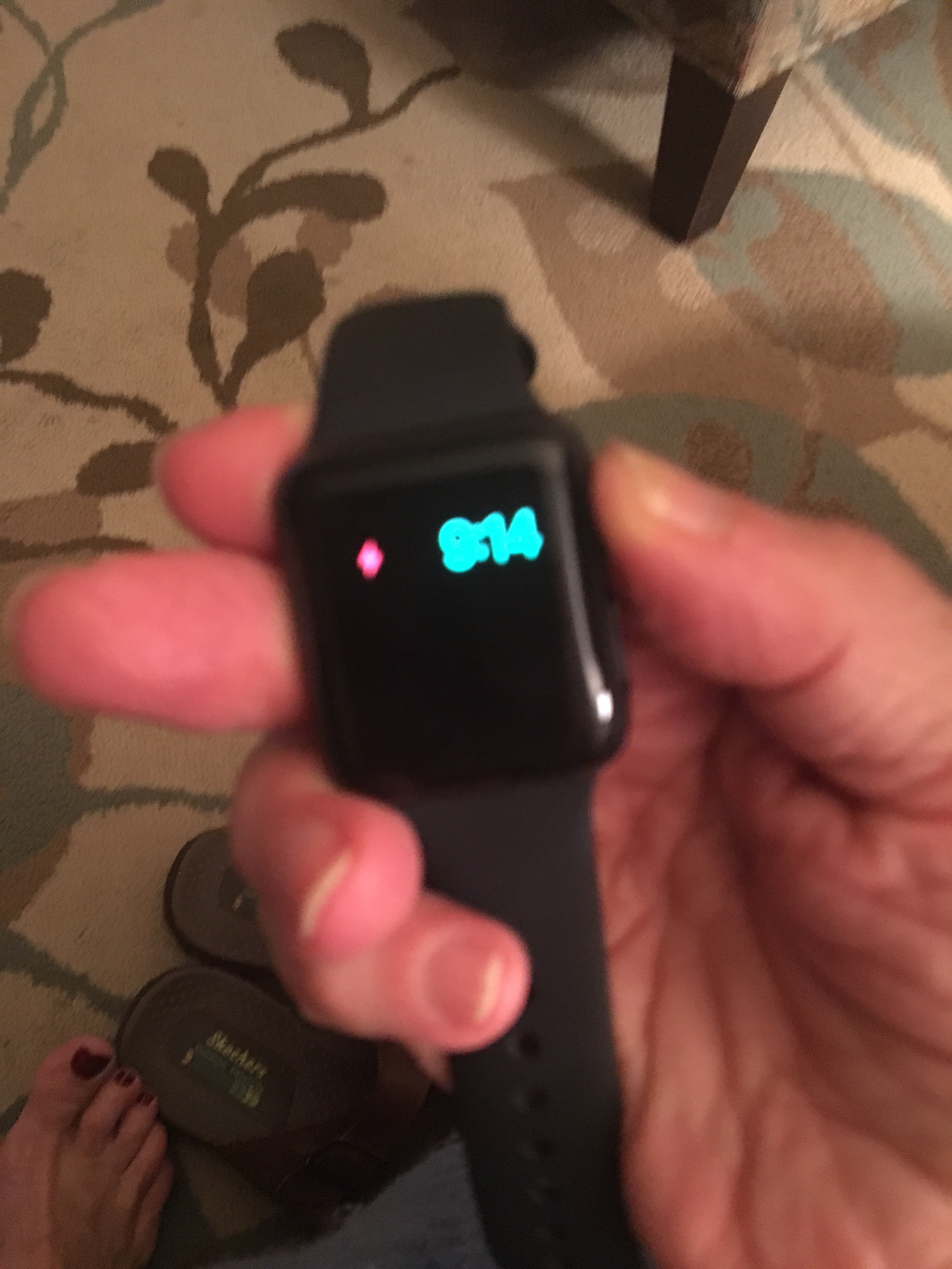 Apple watch is frozen to this screen 