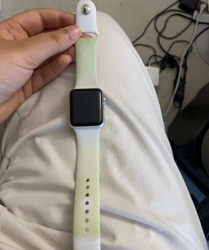 sød Mathis Diligence My white Apple Watch band is turning gree… - Apple Community