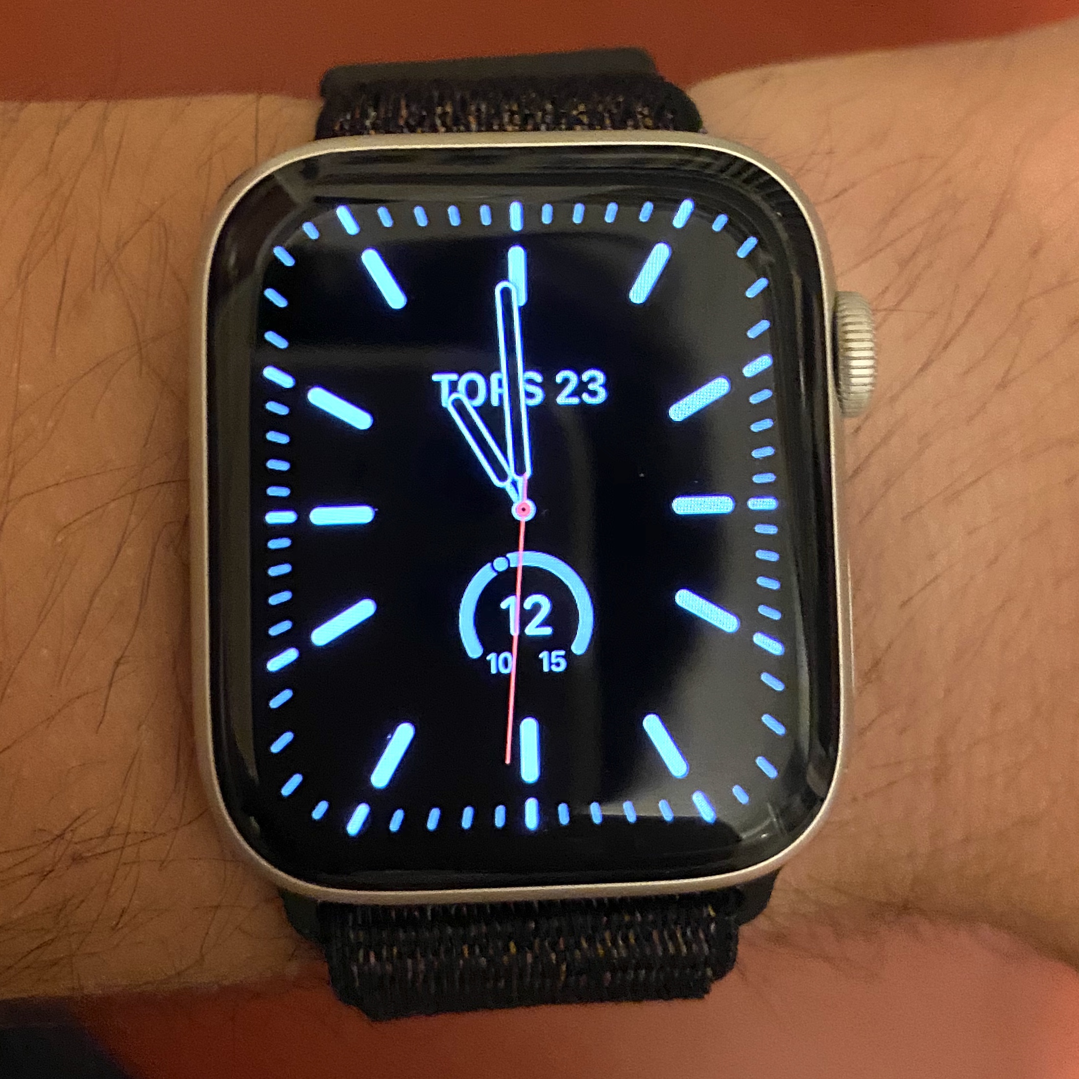 Apple Watch series 5 burn in Apple Community