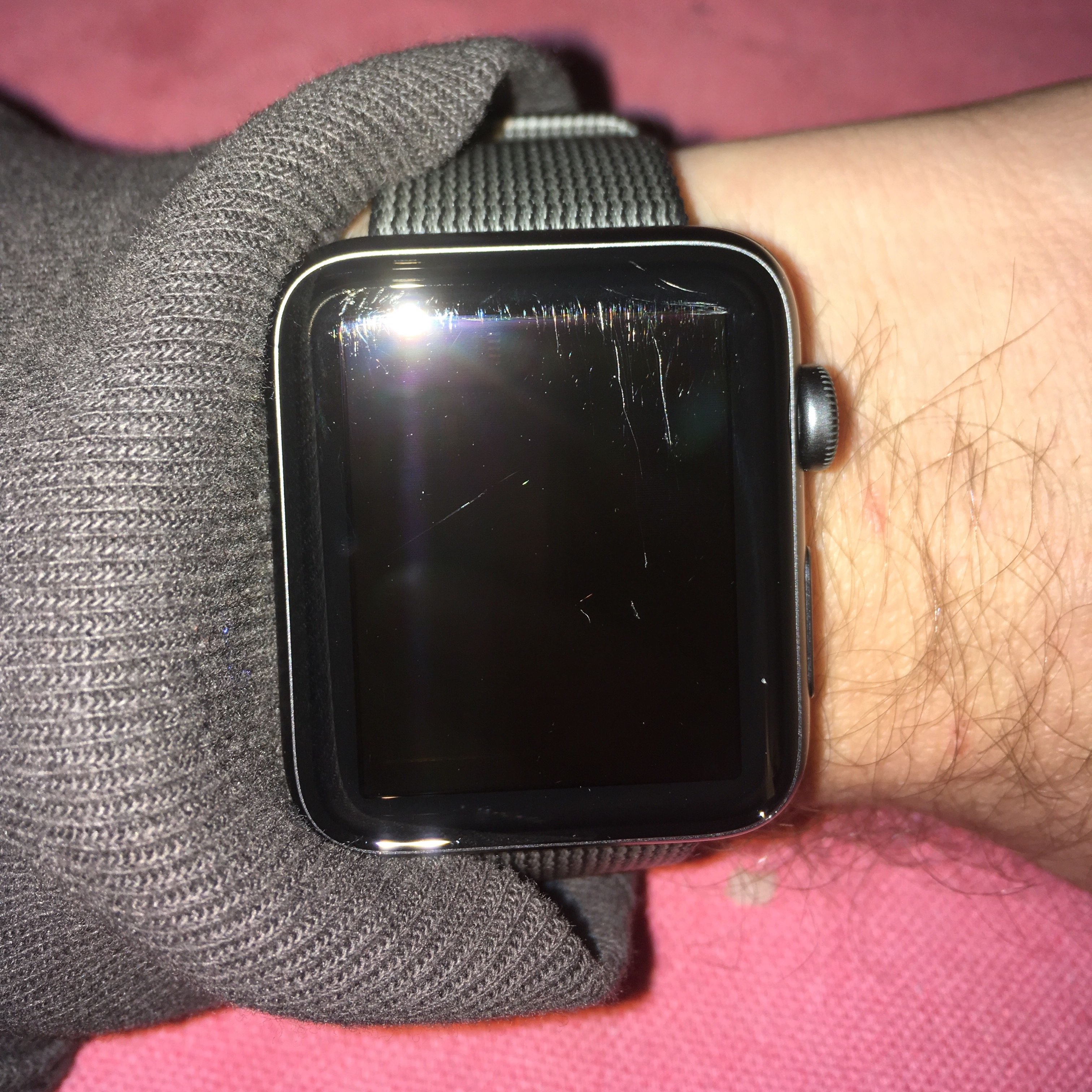 Best way to get rid of Apple Watch scratches without replacing the