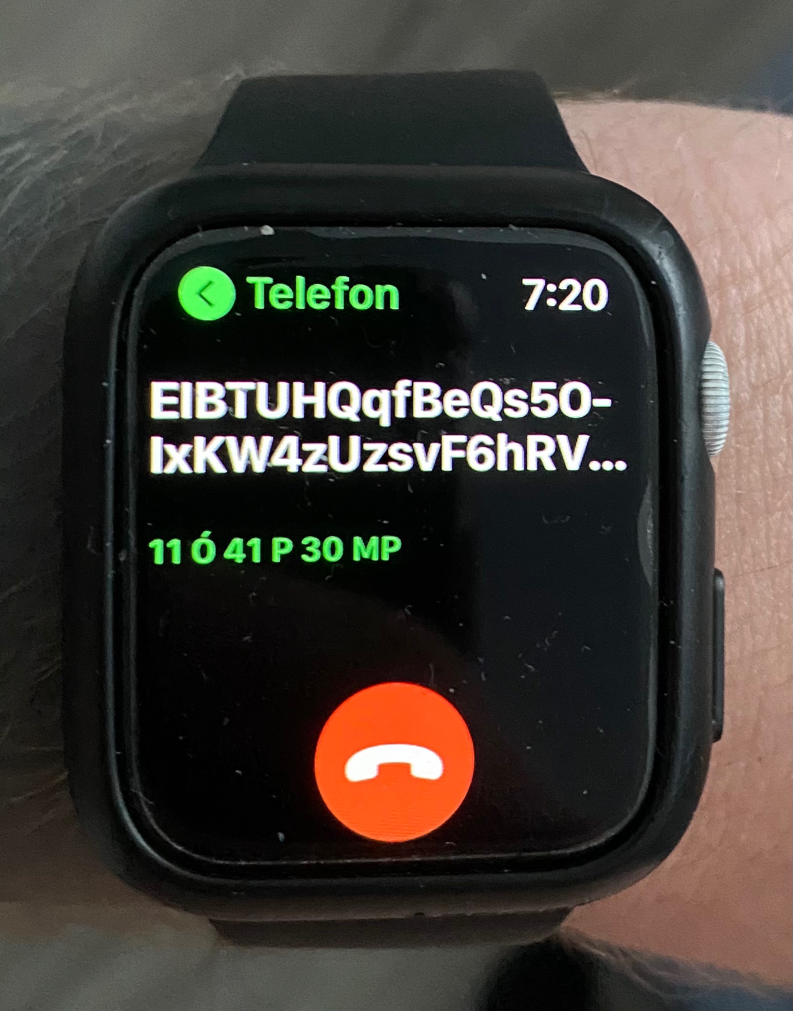 Why is my watch showing this? - Apple Community