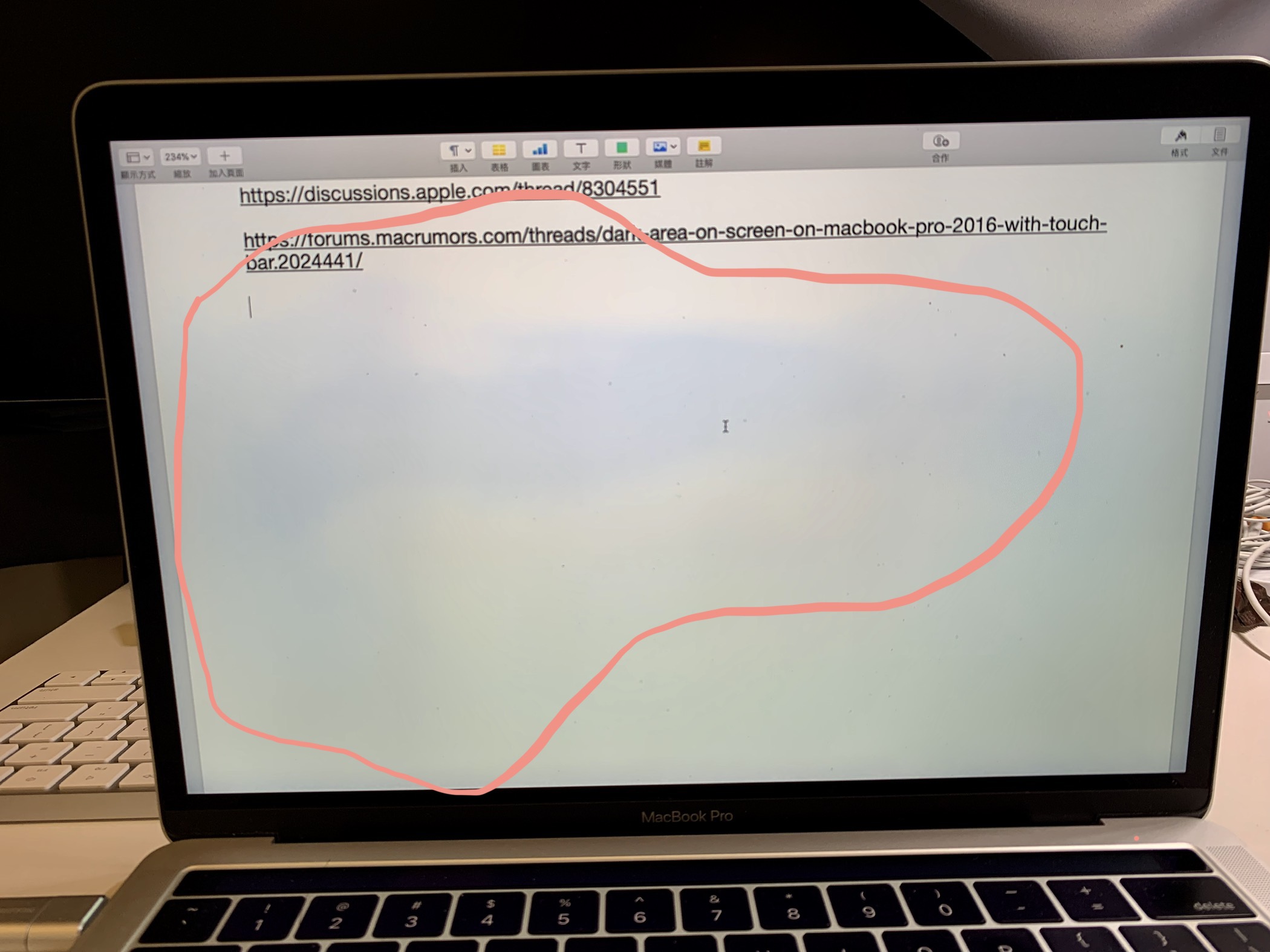 Bluish Spots On My MacBook Pro 13 Screen Apple Community