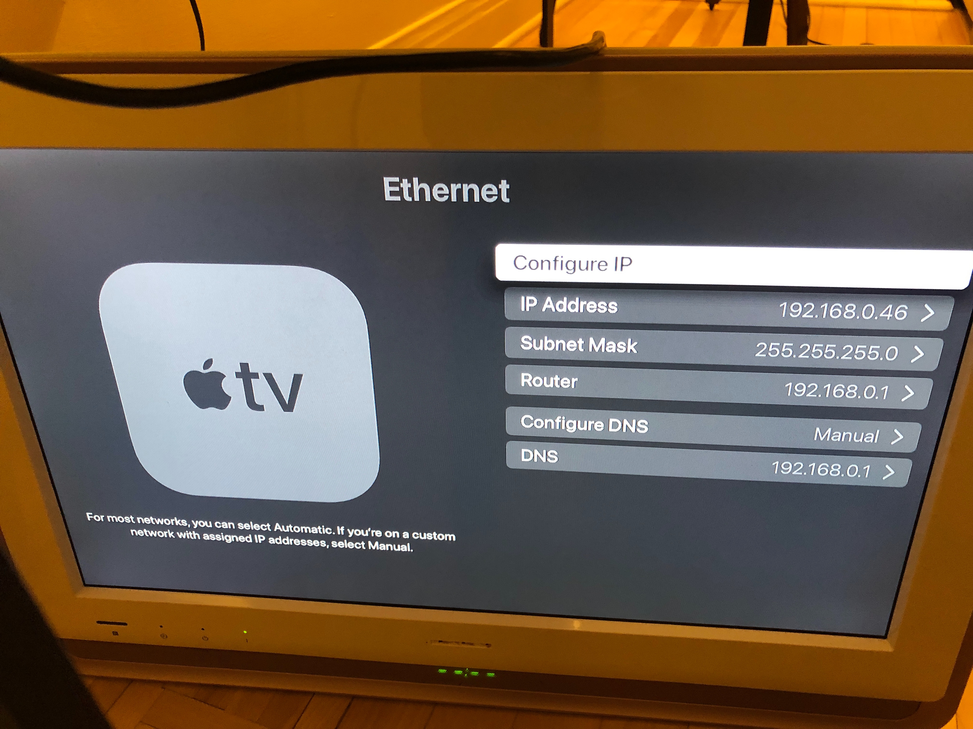 Afståelse Feasibility Knurre Apple TV Gen 4 - A1625 - Preset on ethern… - Apple Community