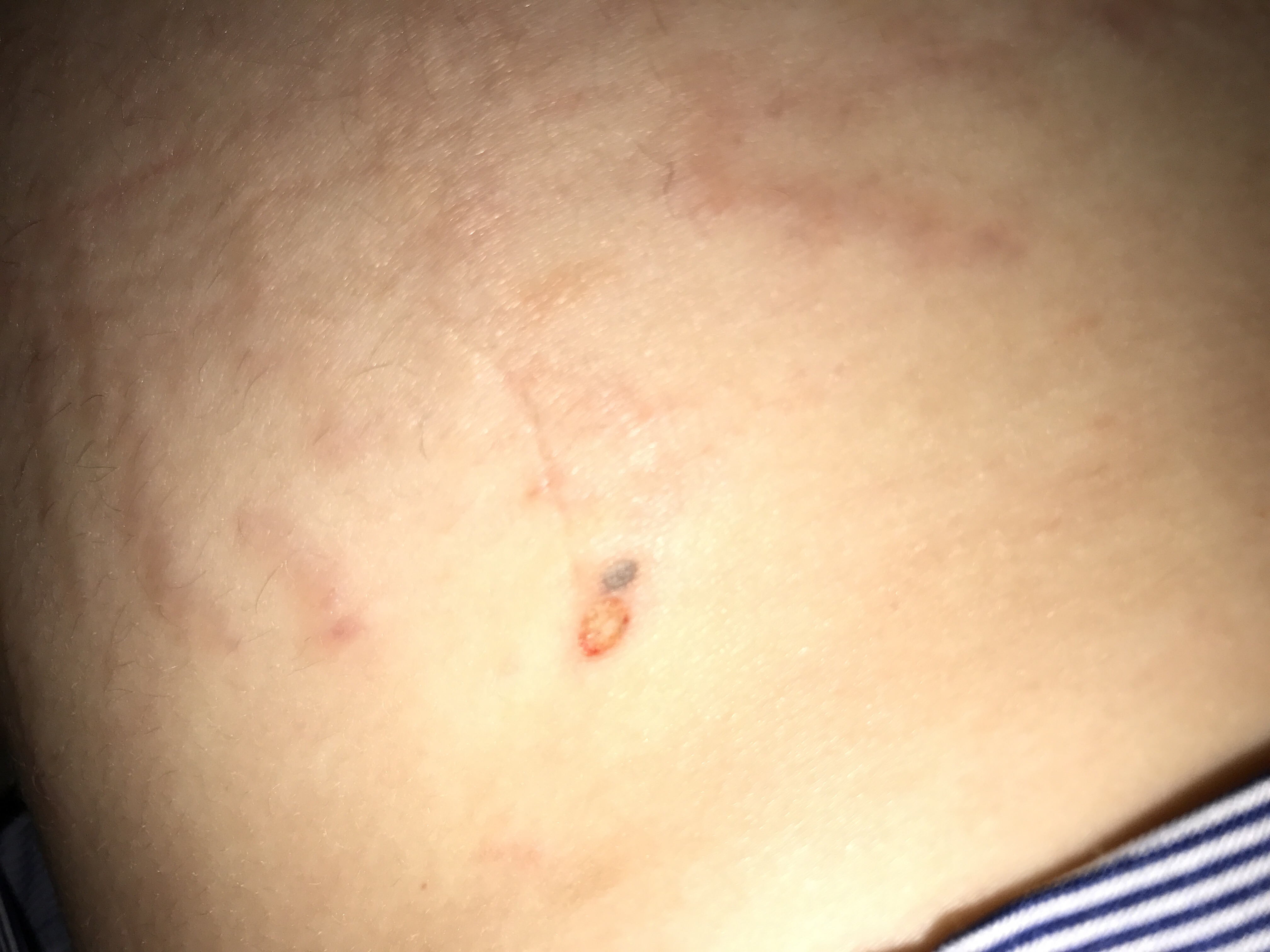 Lightning Cable can burn you.... Apple Community