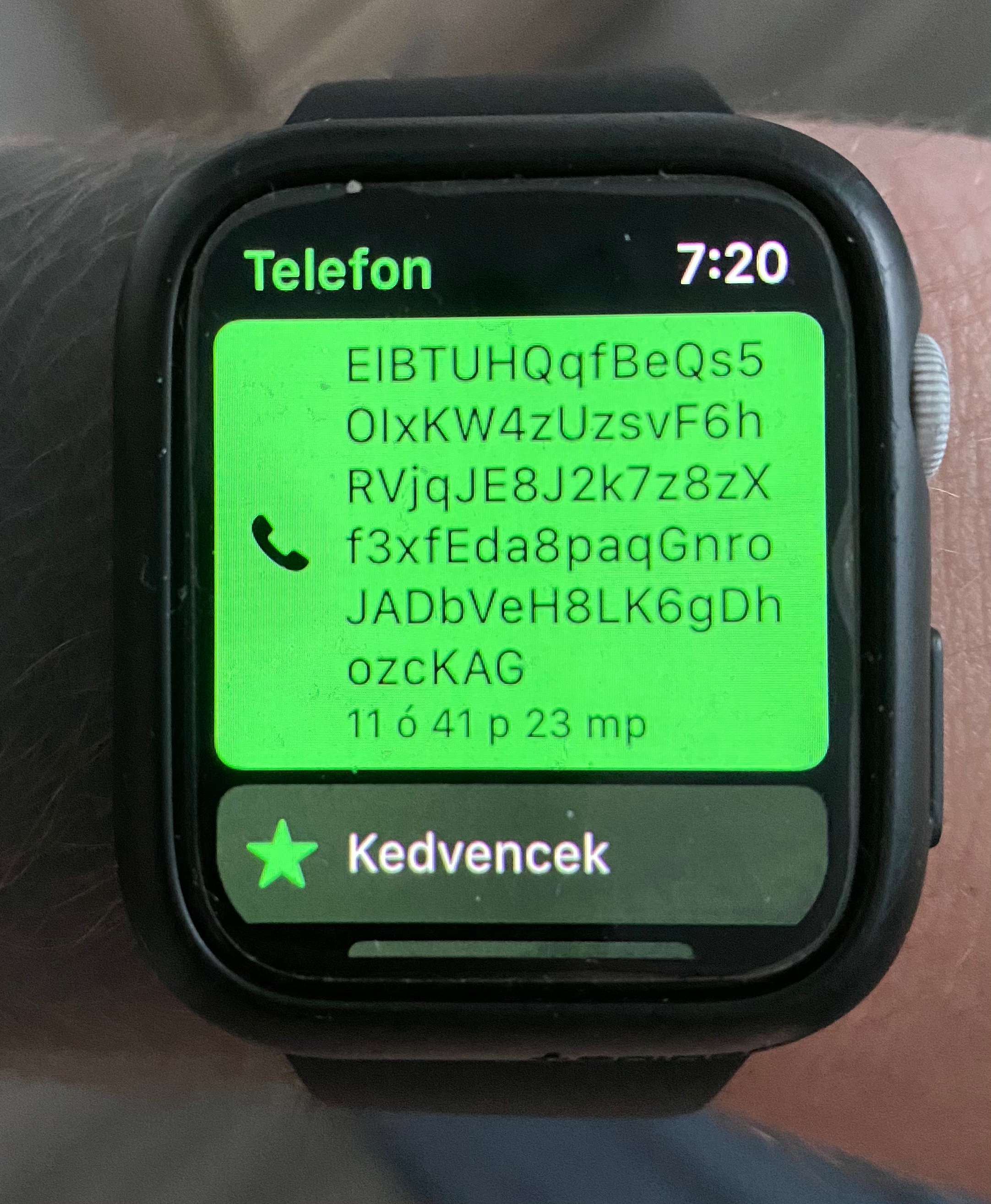 Why is my watch showing this? - Apple Community