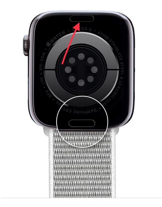 The upper part of my watch wrist band doe… Apple Community