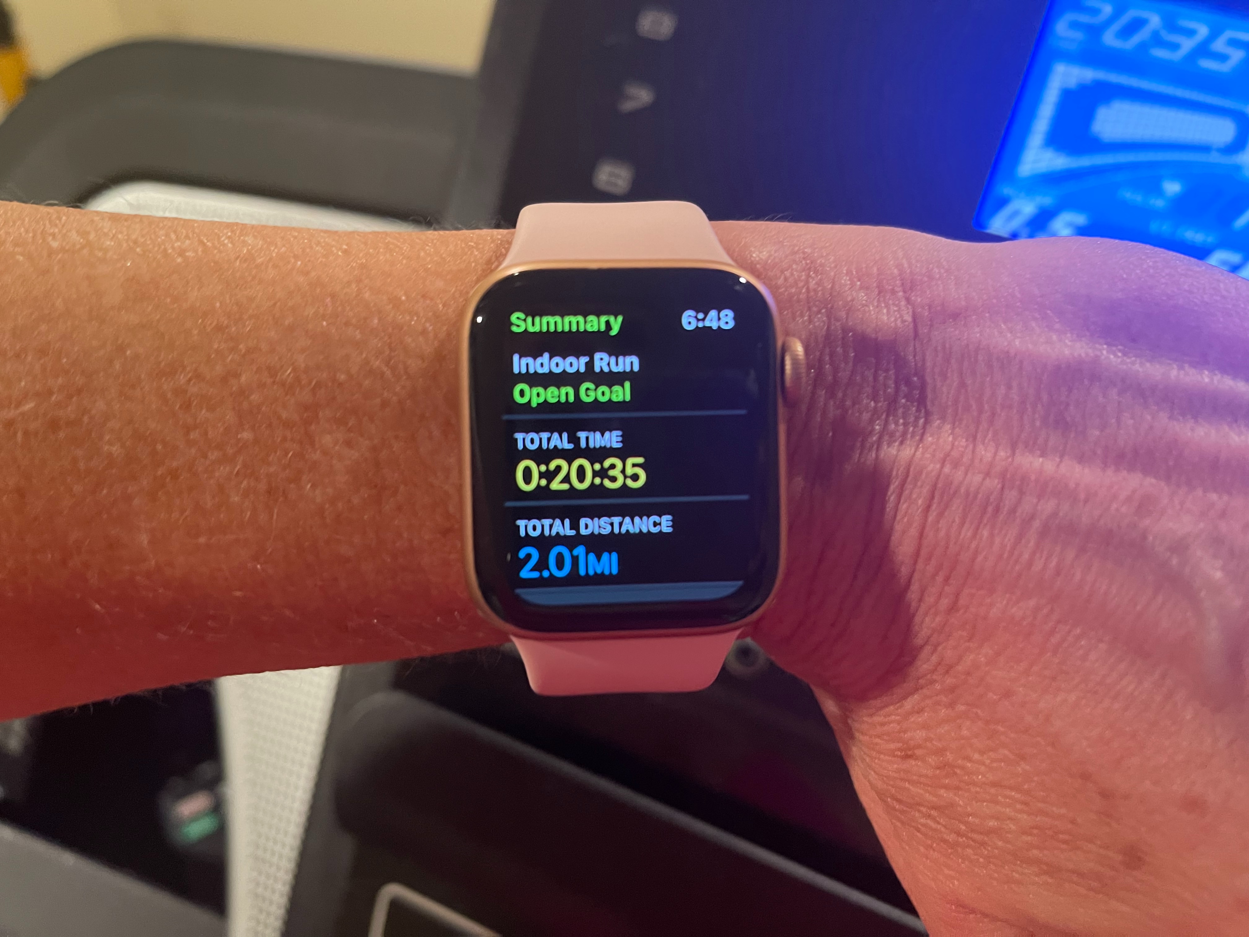 Why Is Treadmill Not On Apple Watch?