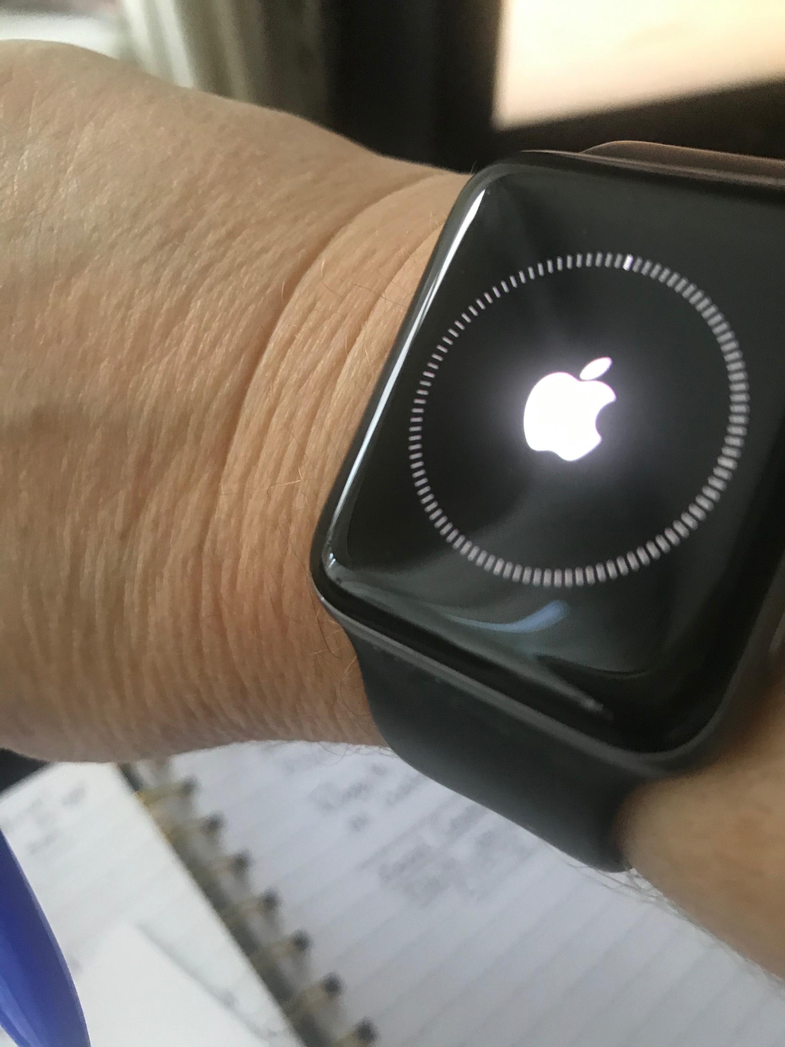 eend Omgekeerd Transplanteren My Apple Watch is suddenly displaying a r… - Apple Community