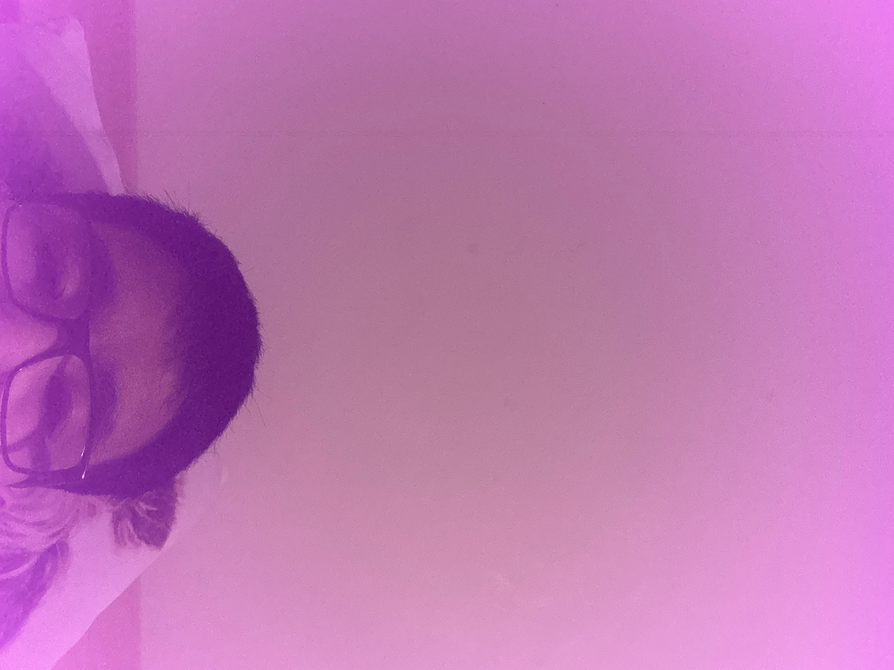 iPhone 15 Pro max front camera problem Apple Community